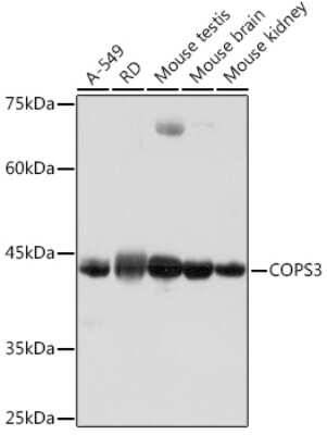 Western Blot: COP9 Antibody (7V1L8) [NBP3-15791]