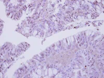 Immunohistochemistry-Paraffin: COP9 Antibody [NBP2-15956]