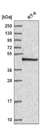 Western Blot: COP9 Antibody [NBP2-55300]