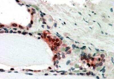 Immunohistochemistry: COP9 signalosome complex subunit 2 Antibody [NB100-1238]