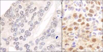 Immunohistochemistry-Paraffin: COP9 signalosome complex subunit 2 Antibody [NB100-363]