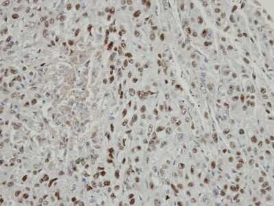 Immunohistochemistry-Paraffin: COP9 signalosome complex subunit 2 Antibody [NBP1-31481]