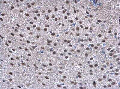Immunohistochemistry-Paraffin: COP9 signalosome complex subunit 2 Antibody [NBP1-31481]