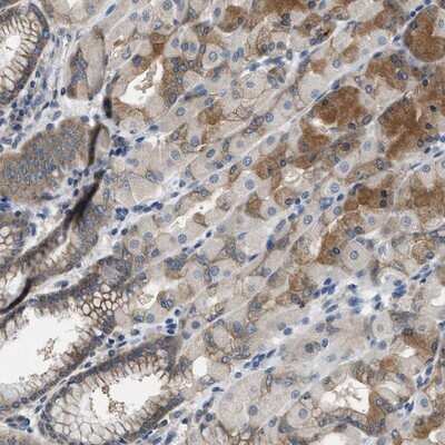 Immunohistochemistry-Paraffin: COP9 signalosome complex subunit 2 Antibody [NBP1-90189]