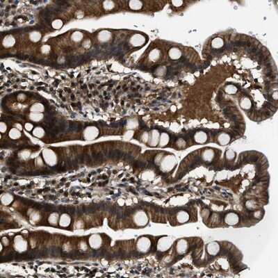 Immunohistochemistry-Paraffin: COP9 signalosome complex subunit 2 Antibody [NBP1-90190]