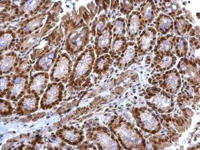 Immunohistochemistry-Paraffin: COP9 signalosome complex subunit 2 Antibody [NBP2-15958]