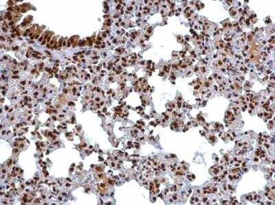 Immunohistochemistry-Paraffin: COP9 signalosome complex subunit 2 Antibody [NBP2-15958]