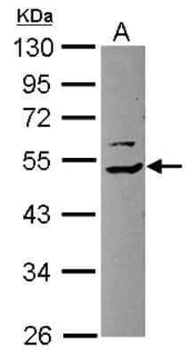 Western Blot: COP9 signalosome complex subunit 2 Antibody [NBP2-15957]