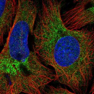 Immunocytochemistry/ Immunofluorescence: COPB2 Antibody [NBP2-54952]