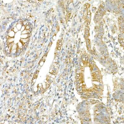 Immunohistochemistry-Paraffin: COPB2 Antibody - Azide and BSA Free [NBP2-92501]