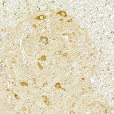 Immunohistochemistry-Paraffin: COPB2 Antibody - Azide and BSA Free [NBP2-92501]