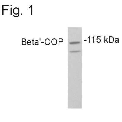 Western Blot: COPB2 Antibody [NB120-2915]