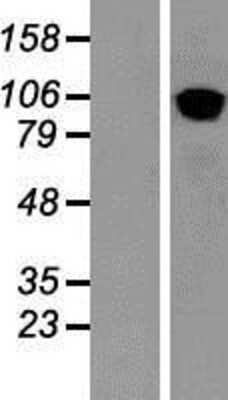 Western Blot: COPB2 Overexpression Lysate [NBP2-07828]