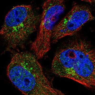 Immunocytochemistry/ Immunofluorescence: COPE Antibody [NBP2-38488]