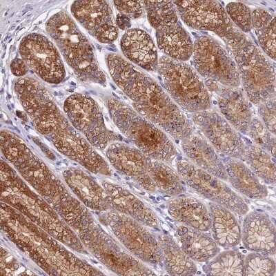 Immunohistochemistry: COPE Antibody [NBP2-38488]