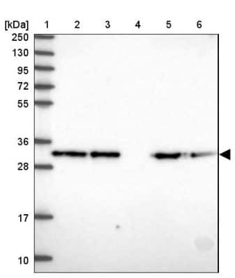 Western Blot: COPE Antibody [NBP2-38512]