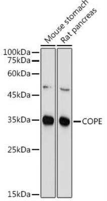 Western Blot: COPE AntibodyBSA Free [NBP2-91992]