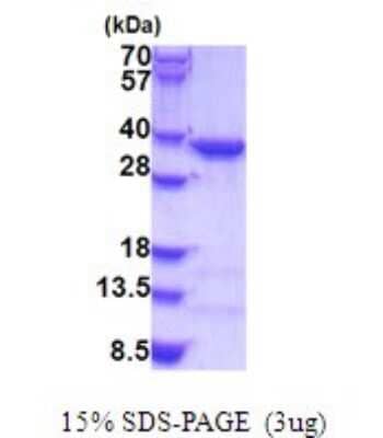 SDS-PAGE: Recombinant Human COPE His Protein [NBP2-51882]