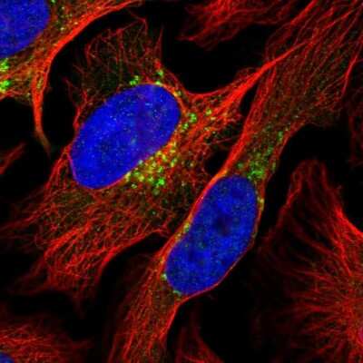 Immunocytochemistry/ Immunofluorescence: COPG Antibody [NBP2-55178]