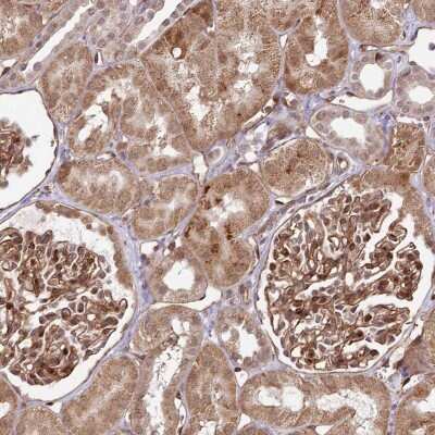 Immunohistochemistry-Paraffin: COPG Antibody [NBP1-85514]