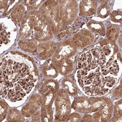 Immunohistochemistry-Paraffin: COPG Antibody [NBP2-55178]