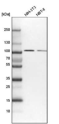 Western Blot: COPG Antibody [NBP1-85514]