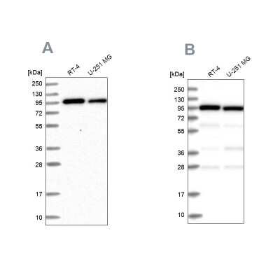 Western Blot: COPG Antibody [NBP1-85514]