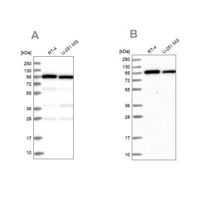 Western Blot: COPG Antibody [NBP2-55178]