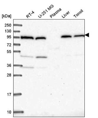 Western Blot: COPG Antibody [NBP2-58317]