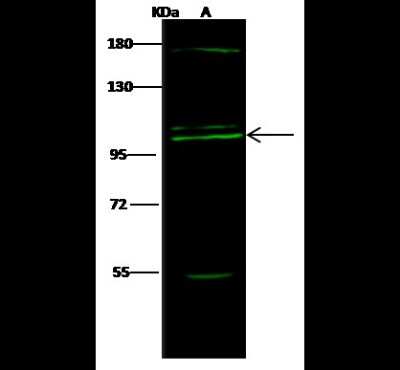 Western Blot: COPG Antibody [NBP2-99186]