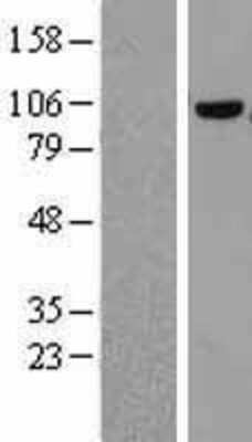 Western Blot: COPG Overexpression Lysate [NBL1-09379]