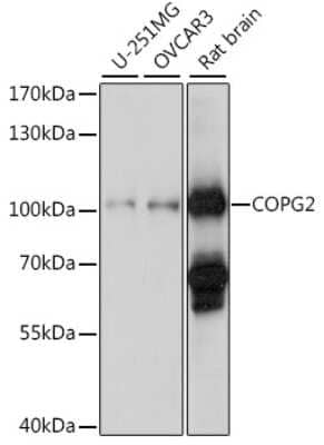 Western Blot: COPG2 AntibodyAzide and BSA Free [NBP2-92868]