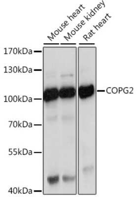 Western Blot: COPG2 AntibodyAzide and BSA Free [NBP2-92869]