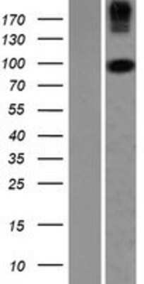 Western Blot: COPG2 Overexpression Lysate [NBP2-07488]