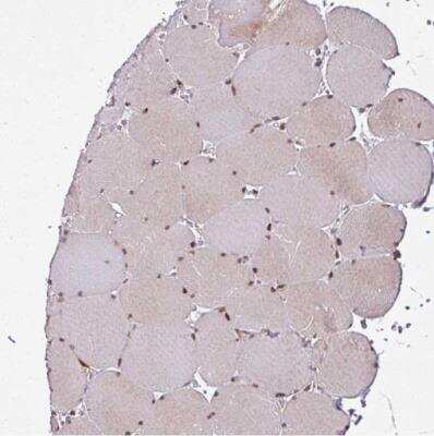 Immunohistochemistry-Paraffin: COPR5 Antibody [NBP2-30884]