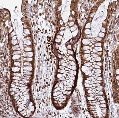 Immunohistochemistry-Paraffin: COPR5 Antibody [NBP2-30884]