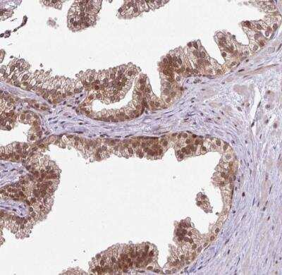 Immunohistochemistry-Paraffin: COPR5 Antibody [NBP2-30884]