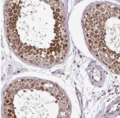 Immunohistochemistry-Paraffin: COPR5 Antibody [NBP2-30884]