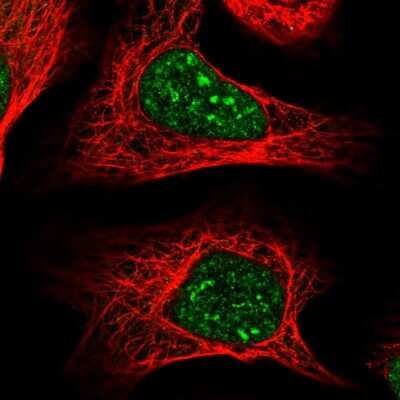 Immunocytochemistry/ Immunofluorescence: COPS4 Antibody [NBP2-55230]