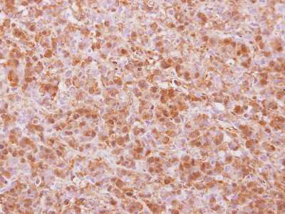 Immunohistochemistry-Paraffin: COPS4 Antibody [NBP2-15962]