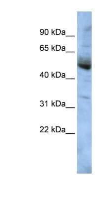 Western Blot: COPS4 Antibody [NBP1-56646]