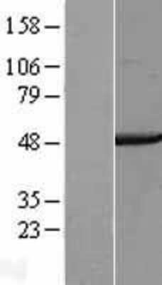 Western Blot: COPS4 Overexpression Lysate [NBL1-09382]