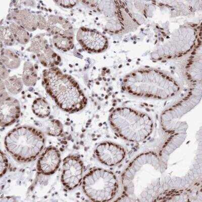 Immunohistochemistry-Paraffin: COPS6 Antibody [NBP1-91805]