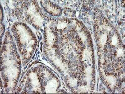 Immunohistochemistry: COPS6 Antibody (OTI4E7) - Azide and BSA Free [NBP2-71648]