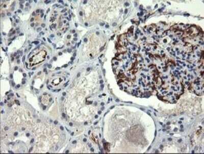 Immunohistochemistry: COPS6 Antibody (OTI4E7) - Azide and BSA Free [NBP2-71648]