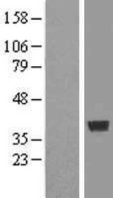 Western Blot: COPS6 Overexpression Lysate [NBL1-09384]