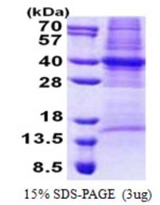 SDS-PAGE: Recombinant Human COPS6 His Protein [NBP2-22798]