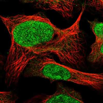 Immunocytochemistry/ Immunofluorescence: COPS7A Antibody [NBP1-84369]