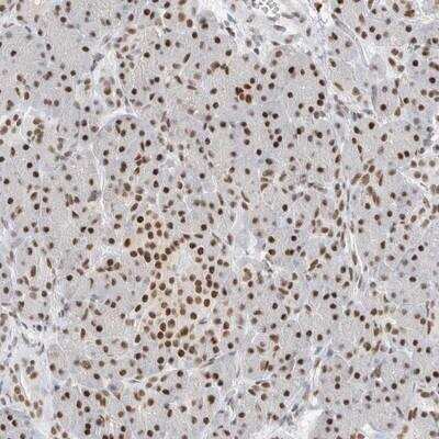 Immunohistochemistry-Paraffin: COPS7A Antibody [NBP1-84369]