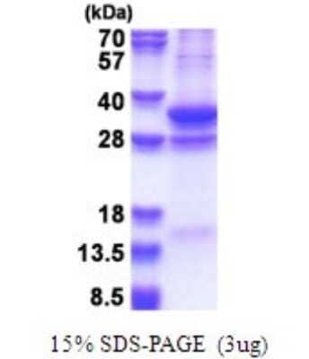 SDS-PAGE: Recombinant Human COPS7A His Protein [NBP2-51665]